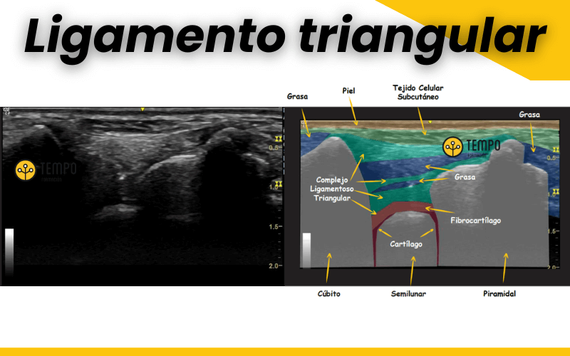 3. Ecografia muñeca anatomia tempo formacion.png